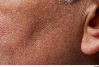 HD Face Skin Reuben Panjaitan cheek ear face skin pores…